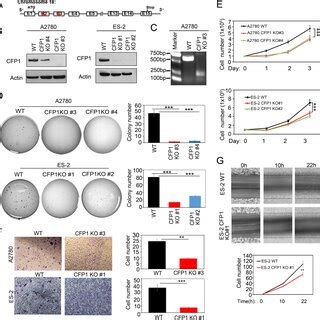 Expression Pattern Of Cfp In Ovarian Cancer Tissues And Ovarian Cancer