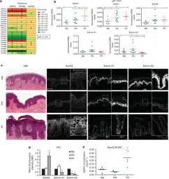 Increased Epha Levels In The Epidermis Of Psoriatic Lesions A A