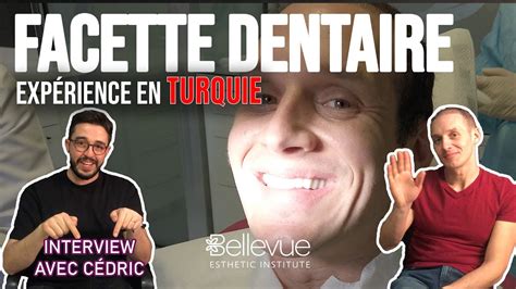 Implant Dentaire En Turquie Et Facette Dentaire Soin Et Explication