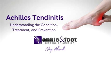 Achilles Tendonitis Treatment Stretches And Exercises