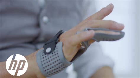 Ot4 S 3d Printed Hand Brace Provides Flexible Yet Sturdy Support Hp Youtube