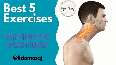 Best 5 Exercise For Kyphotic Forwarded Head And Rounded Shoulders