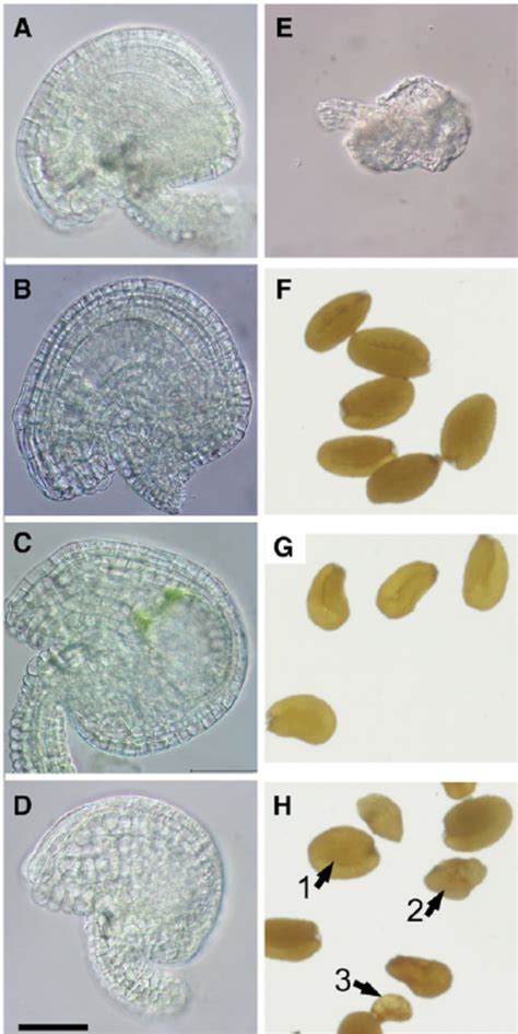 Phenotypes Of Ovules And Mature Seeds Of Heterozygous Eno1 Mutants In