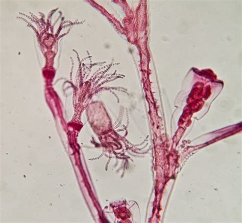 Obelia Under Microscope