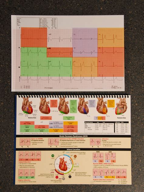 12 Lead Placement Cheat Sheet Printable