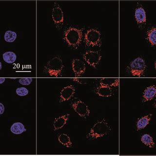 Confocal Images Of HeLa Cells Upon Incubation With TATTPDC NPs A And