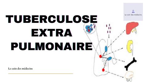 Tuberculose Extra Pulmonaire Youtube