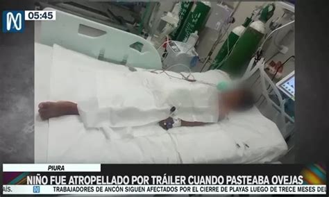 Piura Niño fue amputado de una pierna tras ser atropellado por tráiler