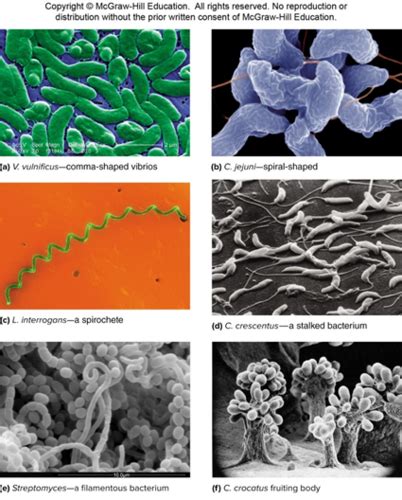 Microbiology Exam Chapter Bacterial Cell Structure Flashcards