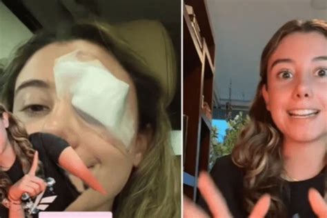 Mujer Termina En El Hospital Tras Probar Truco De Belleza De Tiktok