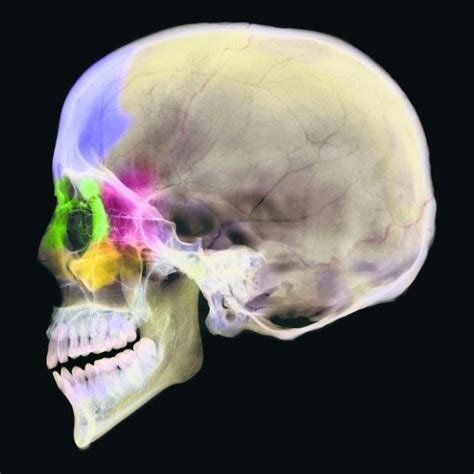 Paranasal Sinuses X Ray Anatomy - TondahtyuiMcfall