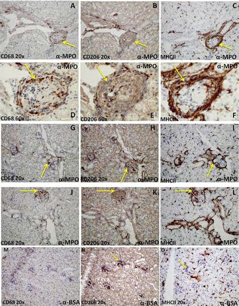 Immunohistochemical Staining To Identify The Macrophage Phenotype