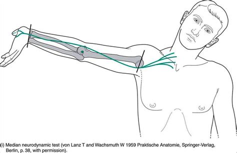 Upper Limb Tension Test