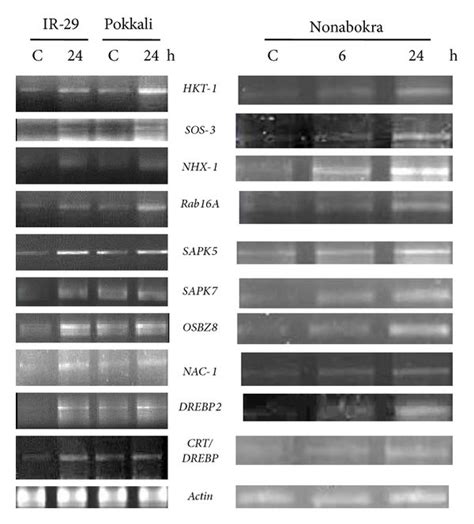 Semiquantitative Rt Pcr Analysis Showing Differential Gene Expression Download Scientific