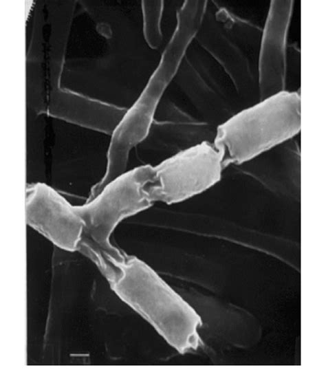 Coccidioides Immitis Spores Arthroconidia Segments Are 2 5 Lm In Size Download Scientific