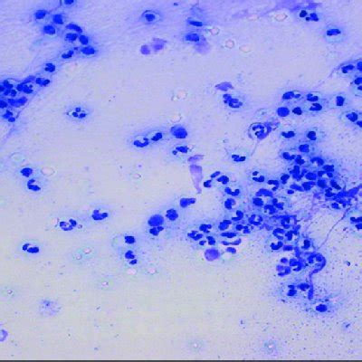 PDF Cytological Endometritis And Its Agreement With Ultrasound