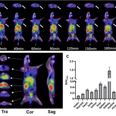 A Pet Ct Imaging Of Ga Wl F Fdg Ga Fapi And