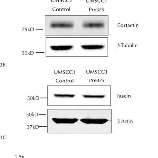 Elevated MicroRNA 375 Expression Does Not Significantly Alter Total