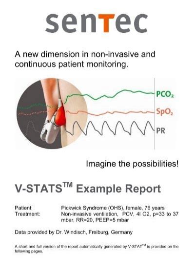 V STATS TM Example Report SenTec AG