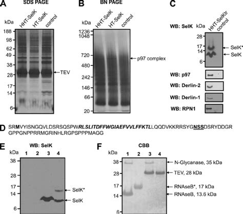 Isolation And Identification Of SelK Associated Proteins AC HEK 293