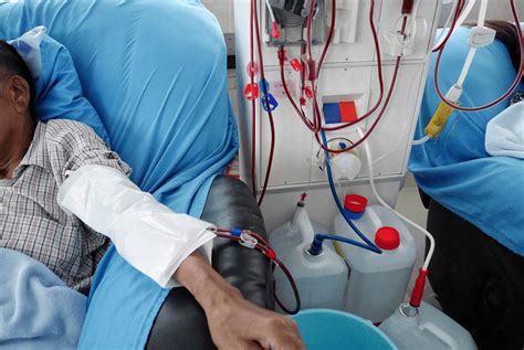 Dialysis Helpful But A Temporary Solution Westlake Medical Center