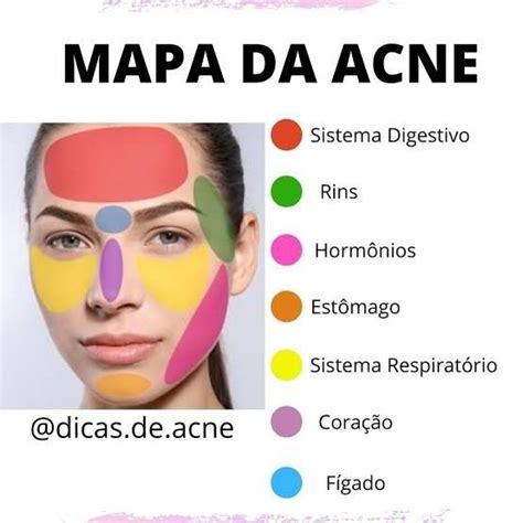 Espinha No Rosto Significado - Espinhas no rosto significado! Mapa da acne.