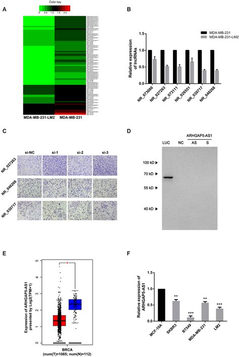 Lncrna Arhgap5 As1 Is Downregulated In Aggressive Breast Cancer Tissues