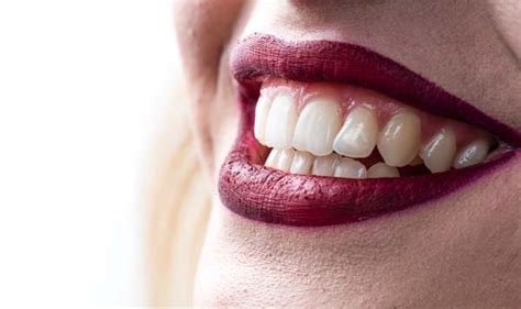 3 Ways Cosmetic Dentistry Can Improve Your Smile Hollywood Smiles