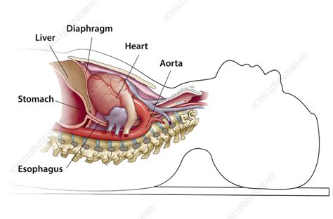 Anatomy in supine position, illustration - Stock Image - C059/3544 ... 