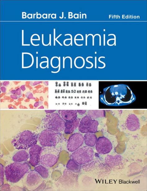 Leukaemia Diagnosis Edition 5 By Barbara J Bain 9781119210542