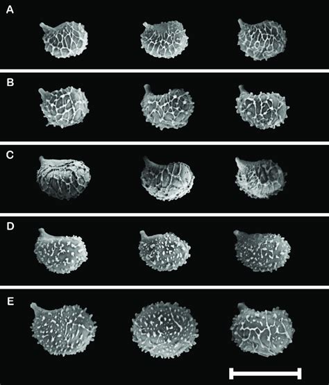 Scanning electron microscope photographs of basidiospores from species... | Download Scientific ...