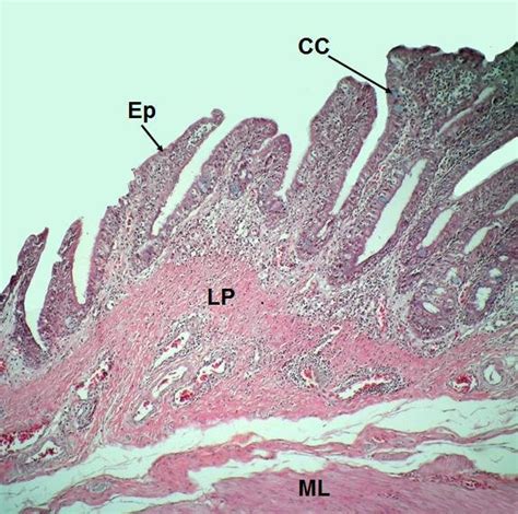 Histologia Bronquio