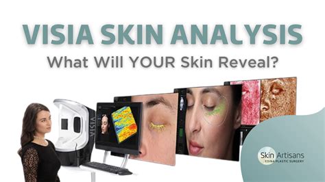 Visia Skin Analysis What Will Your Skin Reveal Skin Artisans