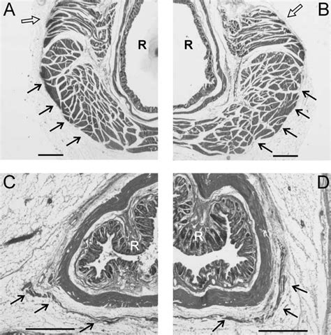 Low Power Photomicrographs Of Sections Through The Perineums Of A Bax