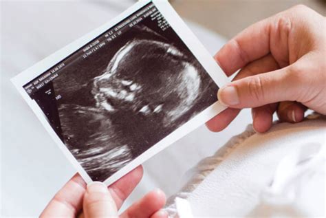 Wellbeing Baby Growth Scan Private Ultrasound Scans London