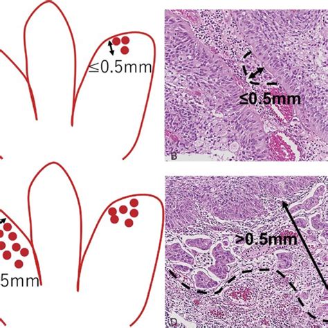 Schematic A And C And Representative Hematoxylin Eosin Stained