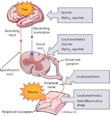 Opioid Analgesics - we know all about it: Opioid analgesics - what is ...