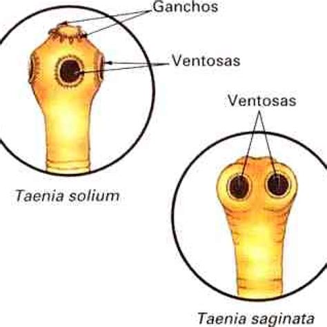 Taenia saginata Taenia solium Taller de Investigación Podcast