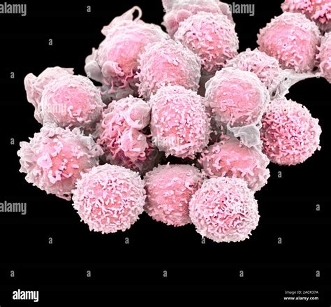 Lymphocyte White Blood Cells Coloured Scanning Electron Micrograph