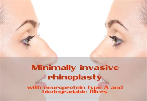 Minimally Invasive Rhinoplasty With Neuroprotein Type A And