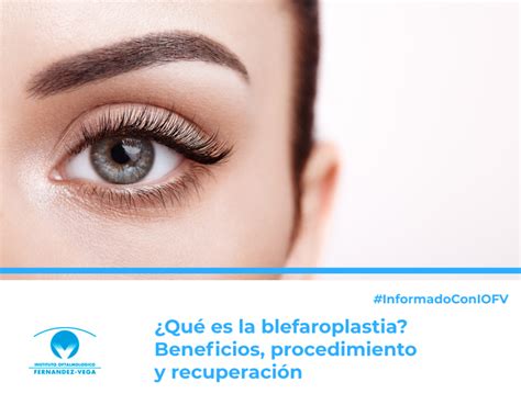 Qu Es La Blefaroplastia Blog Instituto Oftalmol Gico Fern Ndez Vega