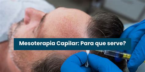 Mesoterapia Capilar Para Que Serve Turquia Hair