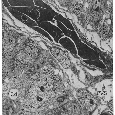 Low Power Electron Micrograph Of The Cephalic Cp Upper Right And