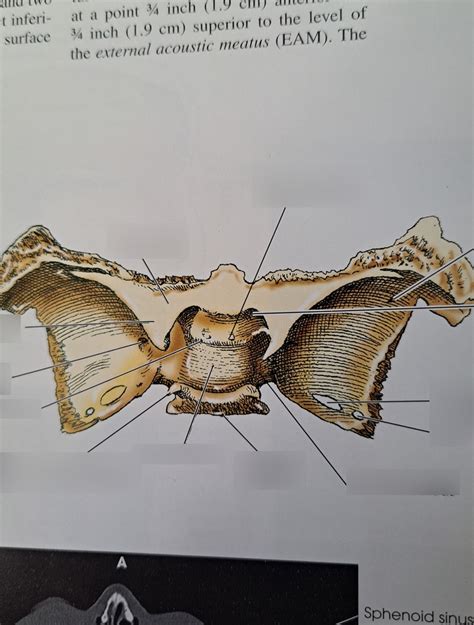 Sphenoid Superior View Diagram Quizlet