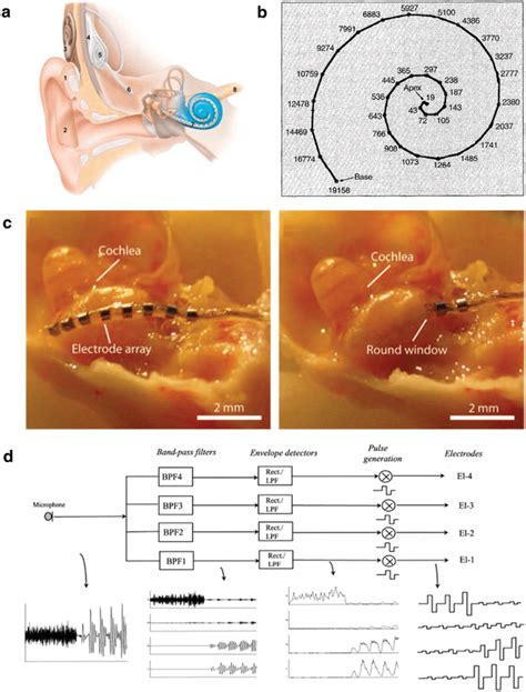 Cochlear Implants With Insertable Electrodes For Hearing Aid A