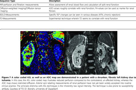 Functional Renal Imaging Sequences Download Table