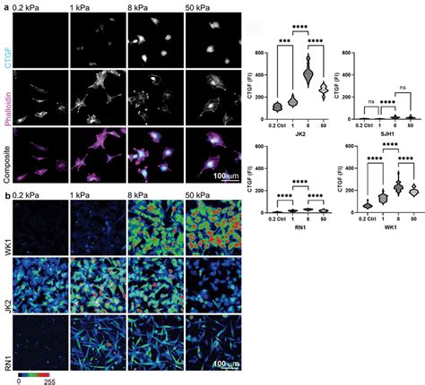 Connective Tissue Growth Factor Ctgf Expression Increases With