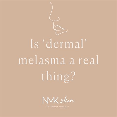 Is ‘dermal Melasma A Real Thing — Nmk — Dr Natalia Spierings
