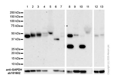 Anti CCR7 Antibody E75 Ab32075 Abcam