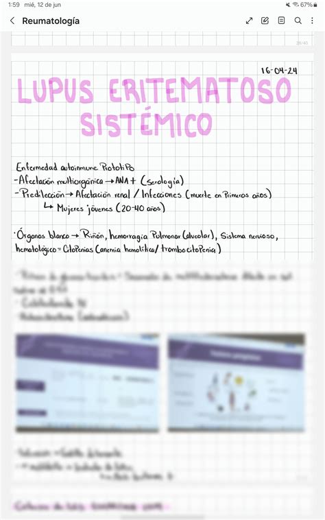 Solution Lupus Eritematoso Sist Mico Studypool